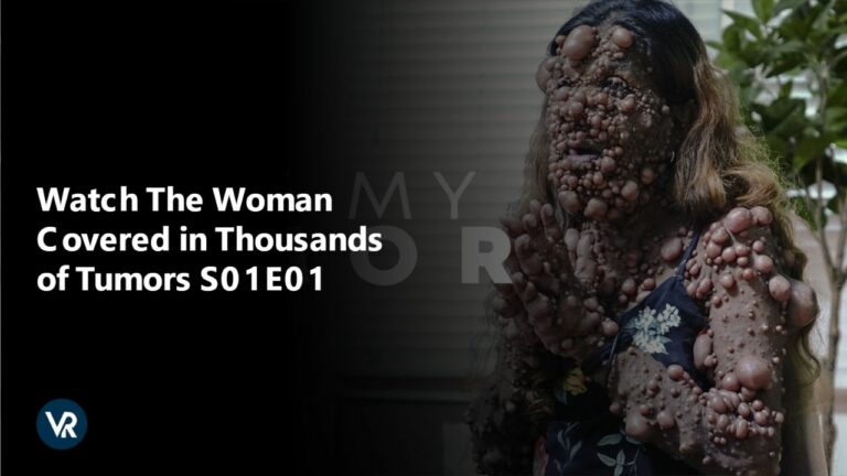 watch-the-woman-covered-in-thousands-of-tumors-s01-e01-in-Canada-on-tlc-using-expressvpn